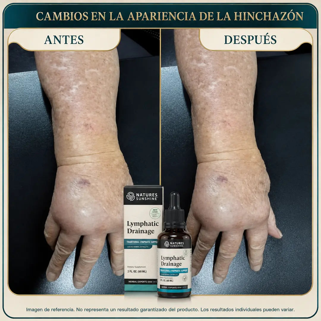 Fórmula Herbal de Apoyo Linfático - AYUDA A DISMINUIR LA APARIENCIA DE HINCHAZÓN