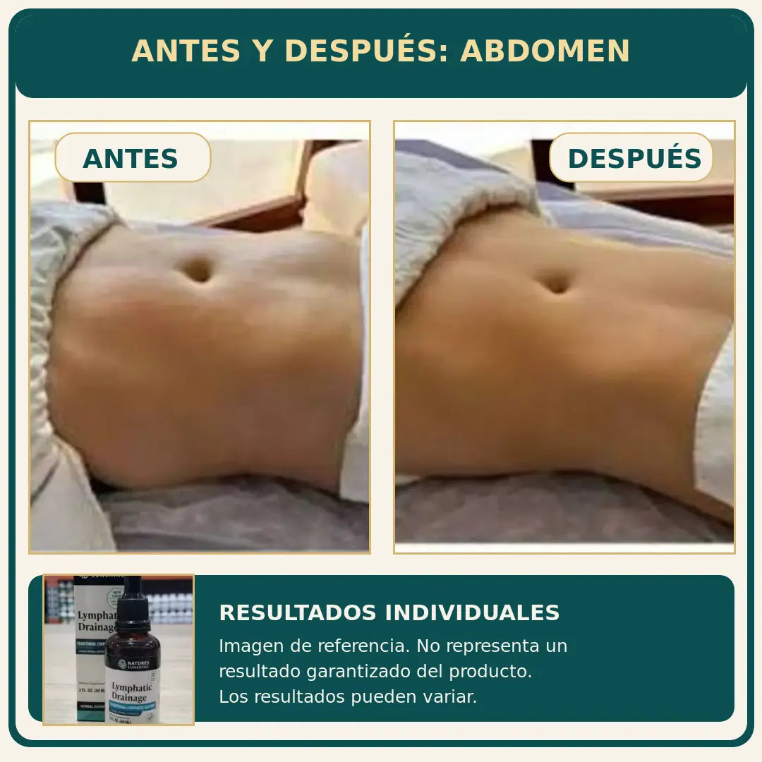 Fórmula Herbal de Apoyo Linfático - AYUDA A DISMINUIR LA APARIENCIA DE HINCHAZÓN