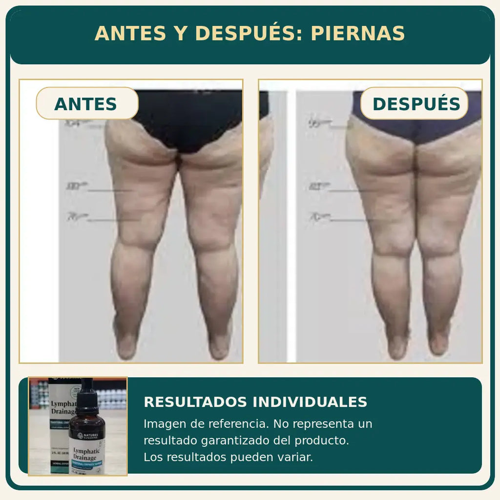 Fórmula Herbal de Apoyo Linfático - AYUDA A DISMINUIR LA APARIENCIA DE HINCHAZÓN